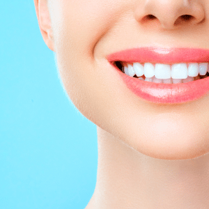 Smiling Spring, TX teeth whitening patient with a bright white smile