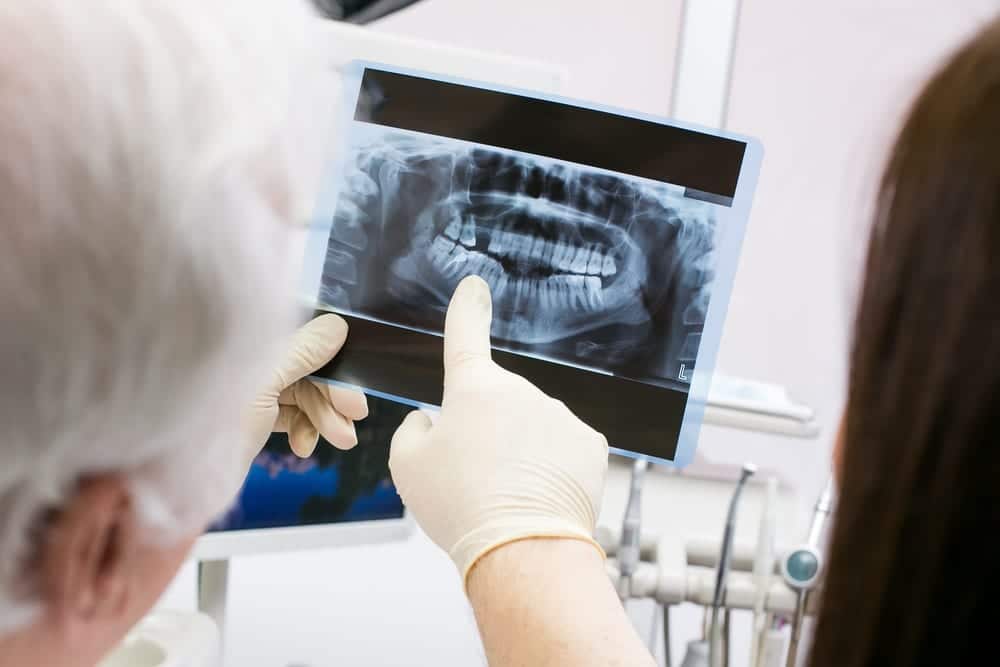 Dentist reviewing a dental xray image in Spring, TX
