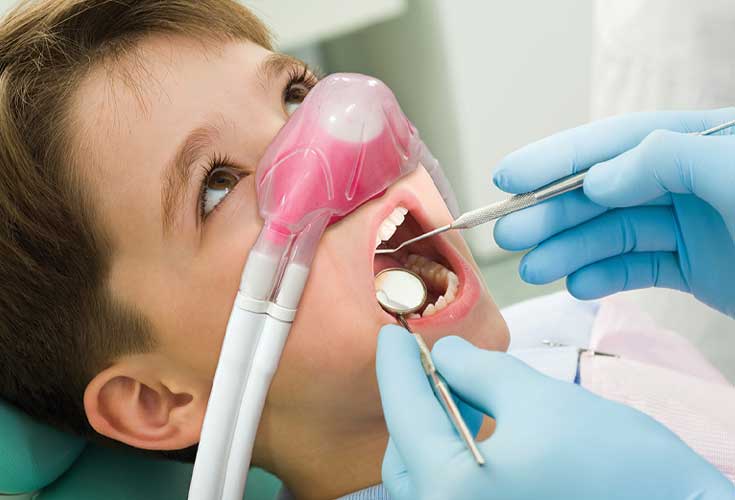 Child with mask on for dental sedation during routine procedure